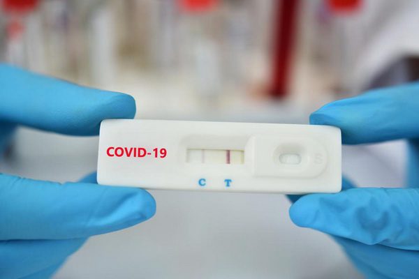 Test Rapid Antigen COVID  c